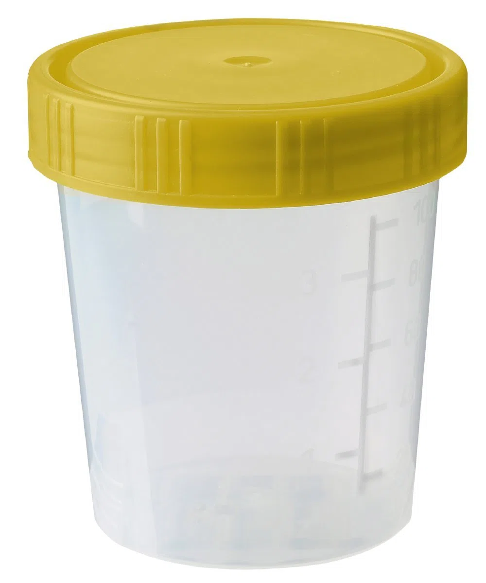 neoLab Polypropylen Becher mit Gelb Schraubdeckel, Strahlensteril, 100ml Kapazität, 56mm x 70mm, 150 Stück